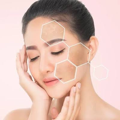 Pigmentation